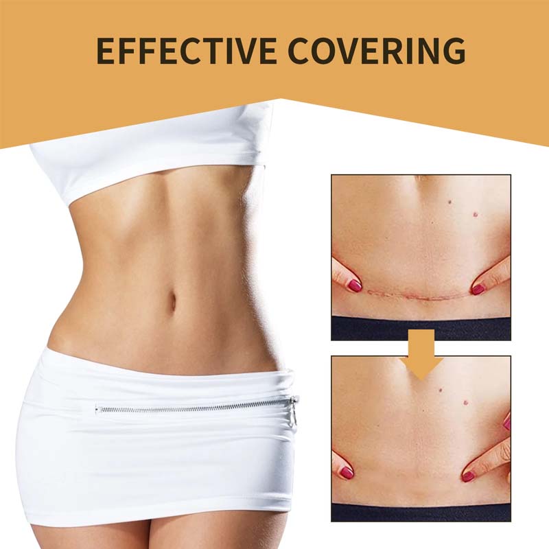 Clear Skin Concealer Sticker Patch