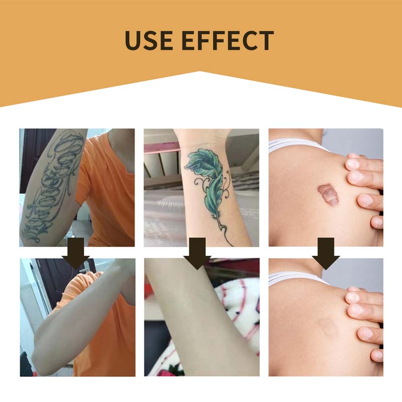 Clear Skin Concealer Sticker Patch