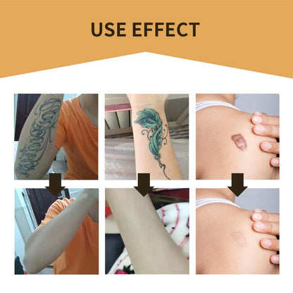 Clear Skin Concealer Sticker Patch