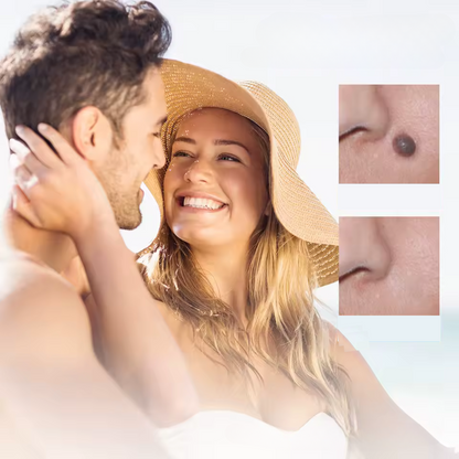 Fast Wart Removal Cream