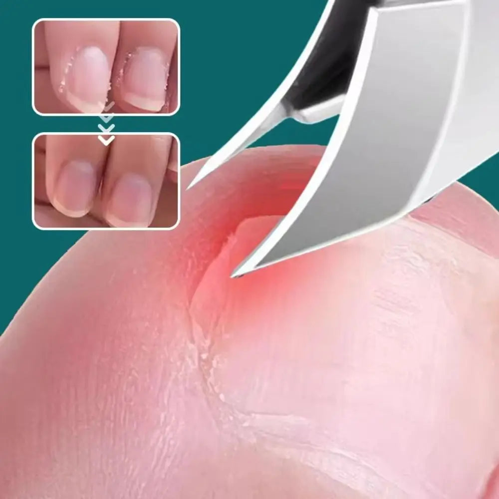 Safe Easy To Use Nail Clipper
