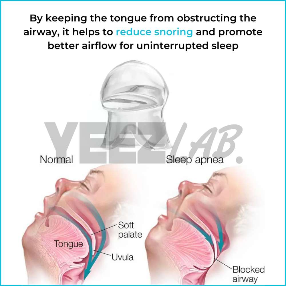 YeezLab™ Anti-Snoring Device – Breathe Easy, Sleep Soundly