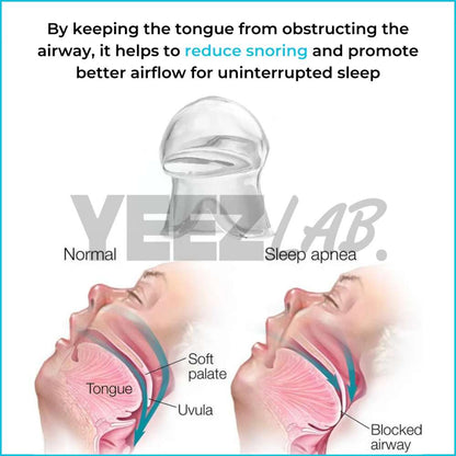 YeezLab™ Anti-Snoring Device – Breathe Easy, Sleep Soundly