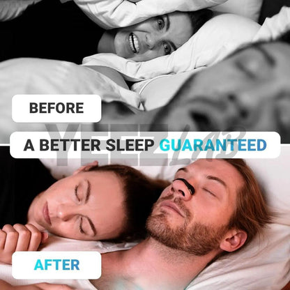 YeezLab™ Magnetic Nasal Dilator – Anti-Snoring & Breathing Relief Strips for Sleep & Sports