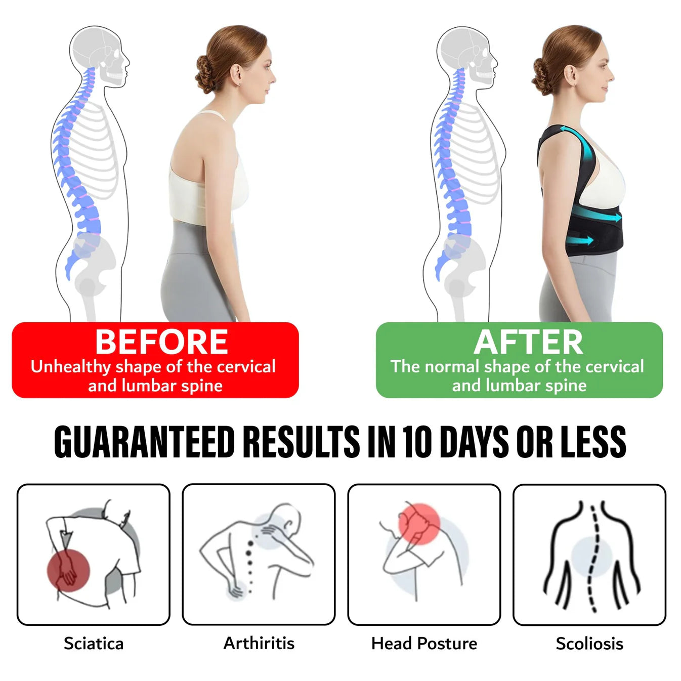 Posture Correcting Back Support Brace