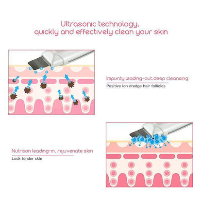 Advanced Facial Cleansing Ultrasonic Skin Care Tool